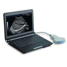 Medizinische Geräte Laptop volldigitalen Portable Scanner Ultraschallgerät